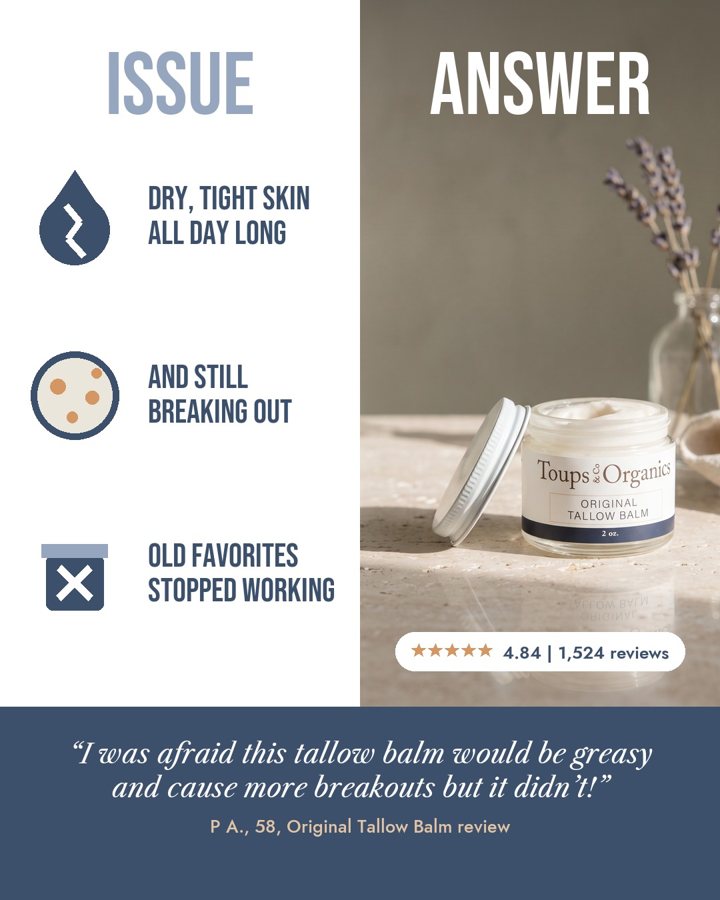 Your skin didn't get worse. It changed. static ad for Toups and Co